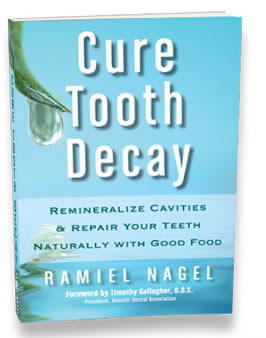 Cure Tooth Decay Book Stop Tooth Decay, Reverse Cavities