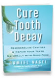 Cure Tooth Decay, Reverse Cavities